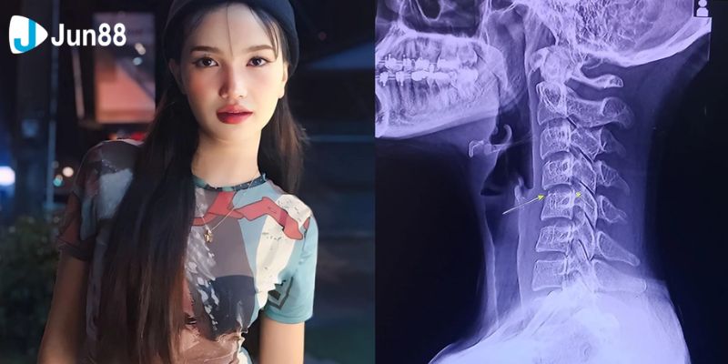 Sự việc của Ping không chỉ thu hút sự quan tâm từ người hâm mộ mà còn gây chú ý trên các phương tiện truyền thông.